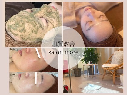 サロン モア(salon more)の写真