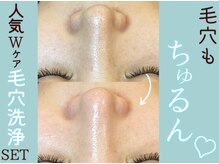 ワンカラット(ONE CARAT)の雰囲気(人気Wケア★REVIハーブピーリング+ハイドロ毛穴洗浄で徹底美肌♪)