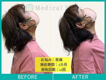 岐阜各務原整体院/首の痛みで上向くのが辛い！