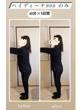 ヨサパーク カルム(YOSA PARK)/ハイディーナ900だけでこの変化