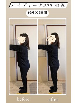 ヨサパーク カルム(YOSA PARK)/ハイディーナ900だけでこの変化