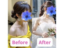 ボディキュア ブライダル美容整体 大阪梅田/【フェイスライン改善】横顔美人