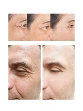 ニコ(Nico.)/肌がもう一度、目覚めはじめる