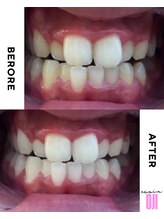 エクシアホワイトニング 王寺店/