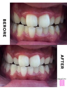 エクシアホワイトニング 王寺店/