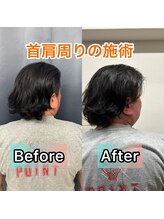 カラダ改善プロジェクト/首肩の施術のビフォーアフター