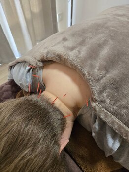 鍼灸整体院ヒビオル【曽根】の写真/【完全個室の贅沢空間】歴10年以上の熟練技!お悩みの箇所を逃さないピンポイント鍼で心身共にリセット♪