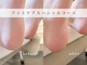 リシェリ(Richer)の写真/素足に、自信が持てる◆見えない部分こそ美しく［明治神宮前表参道/原宿］