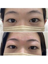 シエル(CIEL)/ハリウッドブロウリフト/HBL