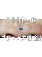 ヒロット タオ(HILOT TAO)/毛穴洗浄はじめました！