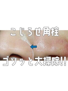 ヒロット タオ(HILOT TAO)/毛穴洗浄はじめました！