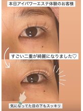 リヒト(Licht)/アイパワーエステ