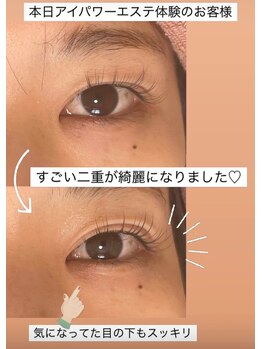 リヒト(Licht)/アイパワーエステ