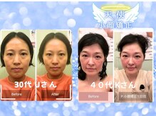 シエロ アスール(Cielo azul)の雰囲気（寝落ちするほどの快感…三度見する驚愕。“魔法”の小顔矯正）