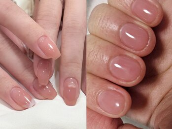 ラヴィン なんばスカイオ店(Lovin)/『パラジェルで深爪を育成』症例