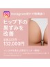 【ローマピンク】ヒップ下☆22万→40％割13,2万円黒ずみ除去