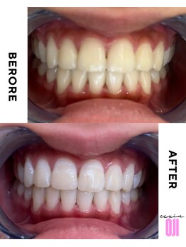 エクシアホワイトニング 王寺店/