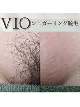 エミライ(emirai)/チクチクしないVIO脱毛