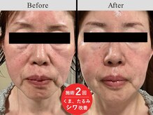 メディカルフェイシャルエステティック サロン ド ヴェリテ(VERITE)/