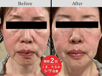 メディカルフェイシャルエステティック サロン ド ヴェリテ(VERITE)/