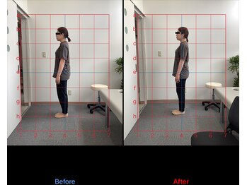 リード整骨院(LEAD整骨院)/姿勢改善、猫背、反り腰