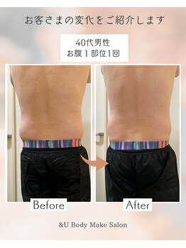 アンドユー(&U)/