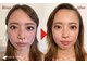 グレースフィオーレ 南越谷店(gracefiore)の写真