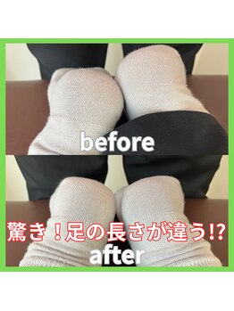 とるこり美姿整体院 新宿院/骨盤矯正Before/After美容整体