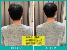 岐阜各務原整体院/首を動かすと痛い！