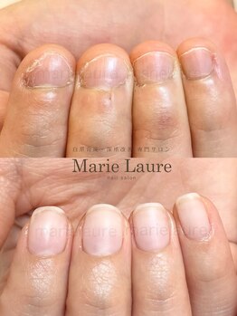 マリーロール 淀屋橋本店(Marie Laure)/自爪育成/深爪矯正/ネイルケア