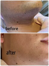 ビーティベーシック(B.t.Basic)/青ヒゲもこのとおり！