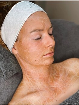 ハリツヤをUPしたい