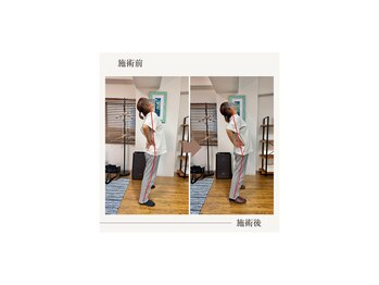 バレルメディカル研究所 恵比寿/ゴルフをやり過ぎて痛めた腰痛