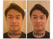 整体ラルース 中目黒(LALUZ)/30代 男性 小顔ヘッドスパ　変化