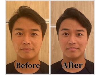 整体ラルース 中目黒(LALUZ)/30代 男性 小顔ヘッドスパ 変化