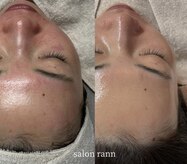 サロン ラン(salon rann)