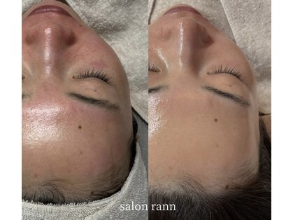サロン ラン(salon rann)の写真