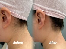 クイーン 渋谷店(QUEEN)/気づかれるほどの美しさへ