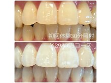 ホワイトニングルーム 横浜店(Whitening Room)/セルフホワイトニング/横浜