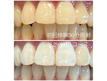 ホワイトニングルーム 横浜店(Whitening Room)/セルフホワイトニング/横浜