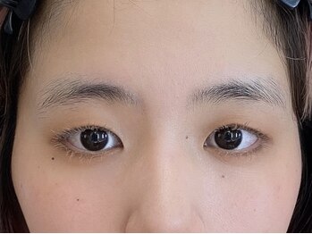 ビューティーガーデン イース/BEFORE