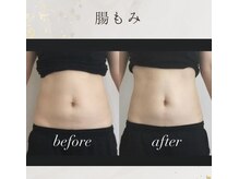 ブレア(Blair)/腸もみ