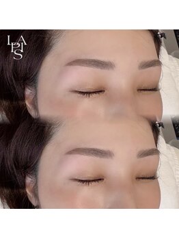 フレイズラピス(FRASE Lapis)/ハリウッドブロウリフト