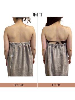 ママニエ(ma maniere)/背中ほっそりコース