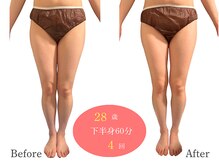 アルピナ(ALPINA)/ウルトランスフォーマー