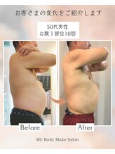 アンドユー(&U)/