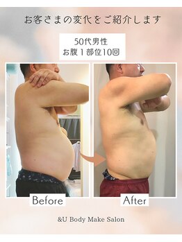 アンドユー(&U)/