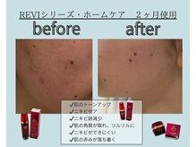 エレナ(ELENA)/当店取扱ホームケア商品REVI
