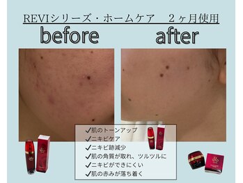エレナ(ELENA)/当店取扱ホームケア商品REVI