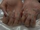 reo_nail【パラジェル・フィルイン・長さだし】の写真